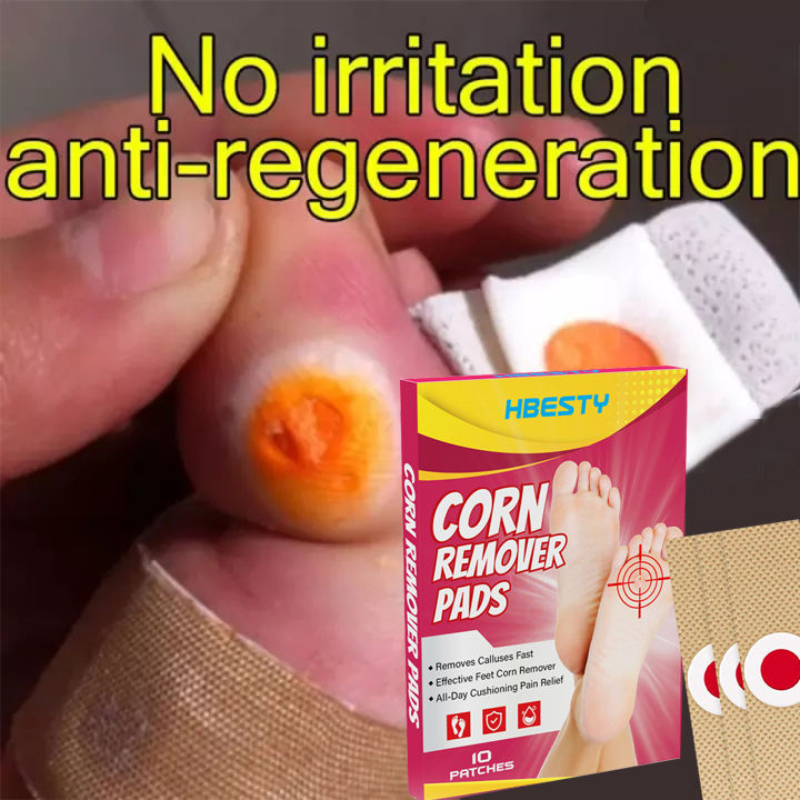 10pcs Feet Corns/ Warts Removal Patch Pain relief, remove calluses