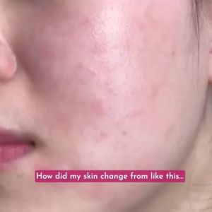 ITSKIN White Tomato Gummies Whitening Skin Extra White Collagen Niacinamide Anti-Aging gummies