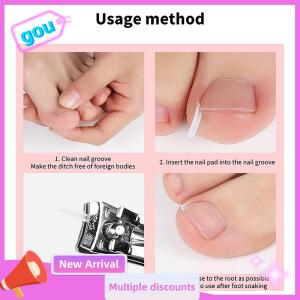 gou 50Pcs Ingrown Toenail Correction Tool Ingrown Toe Nail Treatment Elastic Patch Sticker Straightening Clip Brace Pedicure Tool