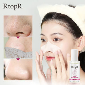 Apphom RtopR Removes Blackheads Acne Deep Cleans Shrink pores Softens Cuticles Mango Extract Safe And Natural Nose Mask