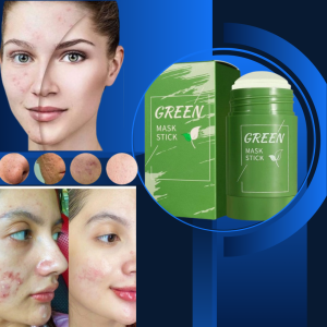 Skincare Wajah Berjerawat Glowing Pemutih Untuk Muka Kusam Kering Berminyak Jerawat Bruntusan Ampuh