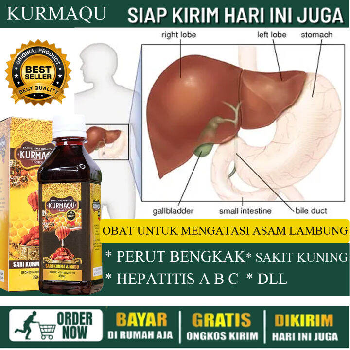 Obat Liver Liver Perut Bengkak Liver Kronis And Ringan Hepatitis A B