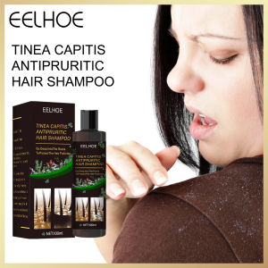 Eelhoe Tinea Capitis Antipruritic Hair Shampoo  Anti-hair Loss And Oil-control Refreshing Shampoo Remove Dandruff Control Itching Tinea Capitis Antipruritic Shampoo（100ml）
