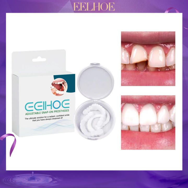 Eelhoe Adjustable Snap On Denture Modification Teeth, Gap Filling