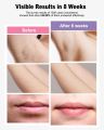 IPL Hair Removal Device Permanent for Women & Men, 999,999 Flashes Safe Effective Lasting Hair Remover, Alternative to Salon, for Face Arms Armpit Legs Bikini Area Whole Body Home Treatment. 