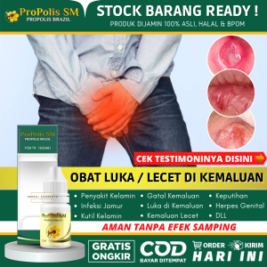 Obat Untuk Atasi Penis Lecet 100% Alami Obat Lecet & Gatal di Penis Pengering Kulit Penis Lecet Lecet di Kepala Penis Ujung Penis Lecet dan Perih Gatal Kemaluan Infeksi Jamur di Penis Basmi Kutu Kemaluan Benjolan Kecil Kecil di Penis - PROPOLIS SM