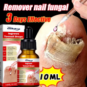 Ubat Kuku Rosak Ingrown Drops Nail Repair Serum Nail Fungus Treatment Ubat Kuku Cekam Toenail Corrector Paronychia Pain Relief 10ML Nail Fungus Treatment Liquid Feet Care Essence Nail Foot Repair Toe Anti Infection
