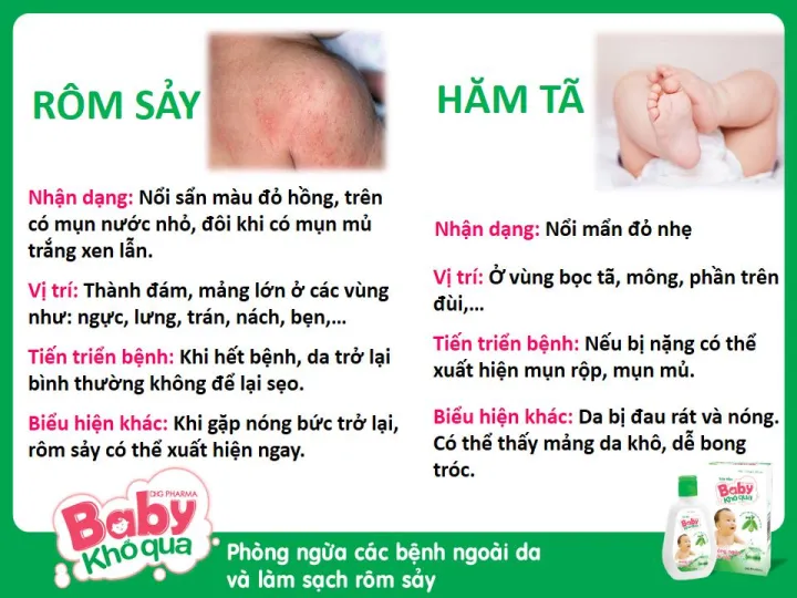 COMBO%203%20H%E1%BB%98P%20S%E1%BB%AEA%20T%E1%BA%AEM%20BABY%20KH%E1%BB%94%20QUA%20TR%E1%BB%8A%20R%C3%94M%20S%E1%BA%A8Y.%20M%E1%BA%AAN%20NG%E1%BB%A8A,%20H%C4%82M%20DA%20CHO%20TR%E1%BA%BA%20-%20Image%207