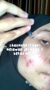 LACOCO DARKSPOT serum penghilang anti flek hitam|| penghilang jerawat|| Lacoco anti flek|| darkspot serum anti flek|| original|| BPOM