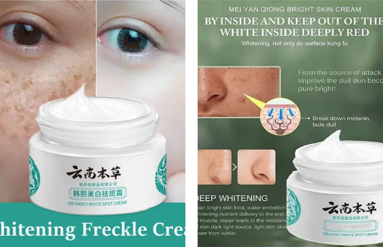 MOST TRUSTED Japanese Melasma Cream White Spot Cream Skin Care