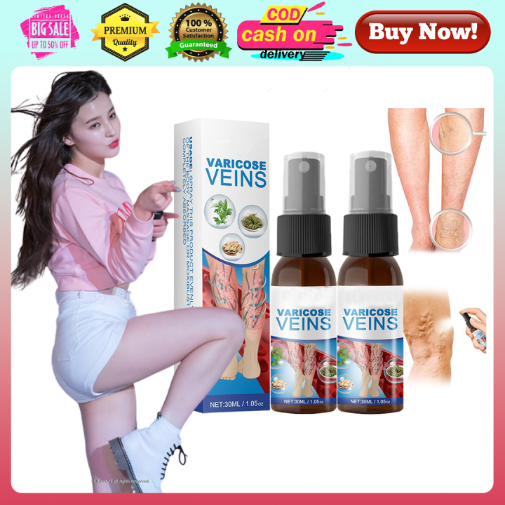 Best And Original Varicose Veins Remover Southmoon Effective Unblocking Veins