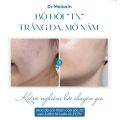 Kem nám Dr Melaxin ,kem nám TX, dưỡng trắng da, mờ nám tàn nhang, giảm thâm 50ml. 