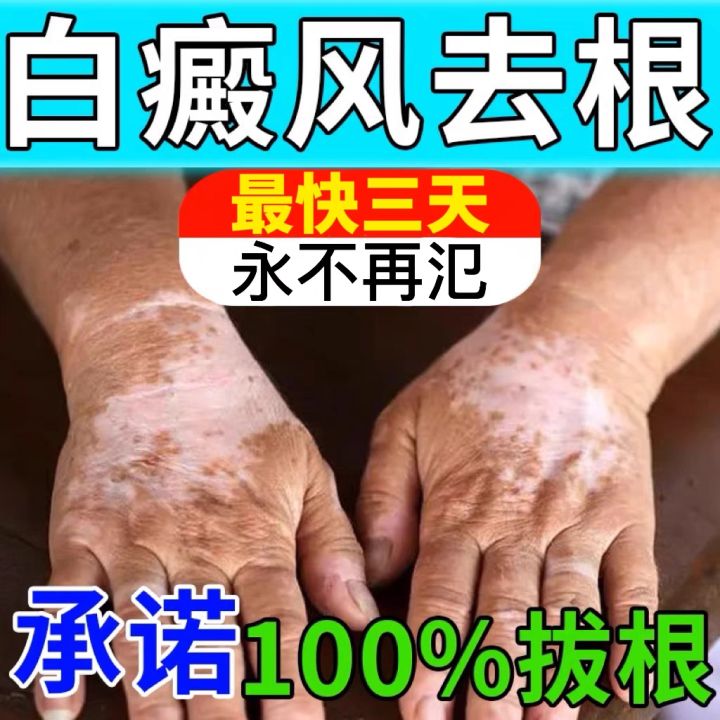 White Spot Cream Body Spot Ointment Flaw Repair Plaster Deep Care Even White Spot Cream Body Spot Ointment Flaw Repair Plaster Deep Care Even