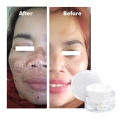 Penghilang Flek Hitam Paling Ampuh BPOM Salep Flek Hitam Ampuh Untuk Menghilangkan Flex Hitam Melasma Salep Flek Melasma Membandel Krim Penghilang Flek Hitam Di Wajah Permanen Cream Flek Khusus Flek Bandel Glowing Cream Leika Penghilang Flek Hitam Melasma. 