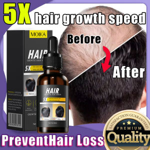 Pertumbuhan rambut penumbuh rambut cepat serum penumbuh rambut botak serum rambut rontok rusak 30ml penumbuh rambut cepat rambut rontok dewasa