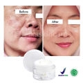 Penghilang Flek Hitam Paling Ampuh BPOM Salep Flek Hitam Ampuh Untuk Menghilangkan Flex Hitam Melasma Salep Flek Melasma Membandel Krim Penghilang Flek Hitam Di Wajah Permanen Cream Flek Khusus Flek Bandel Glowing Cream Leika Penghilang Flek Hitam Melasma. 