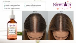 14-in-1 Nourishing Scalp Oil Concentrate | For Men & Women | Coconut · Rosemary · Amla · Onion · Black Cumin & More - 30ml