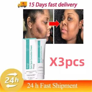 Powerful Spot-removing Whiten Cream Brighten Skin Fast Eliminates Melanin Pigmentation Melasma Dark Spots Moisturize Beauty Gel2026