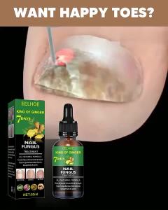 EELHOE  Solusi Perawatan Kuku   Solusi Perawatan Kuku Tangan dan Kaki Pembersihan Harian Mencerahkan Kuku Melembutkan Kuku Melembapkan Perawatan Kuku