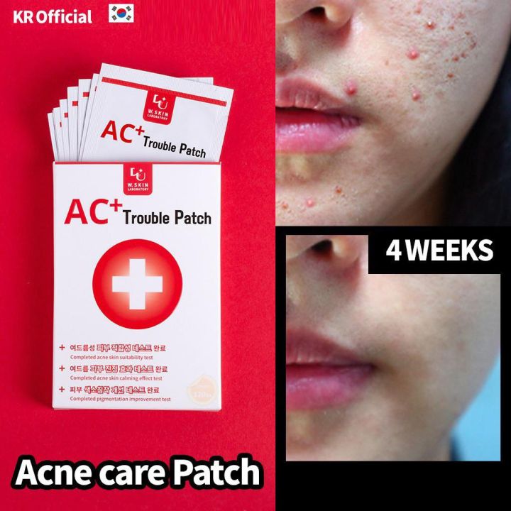 Miếng Dán Mụn Mỏng Nhẹ Trong Suốt Ac+ Trouble Patch Giải Pháp Nhanh ...