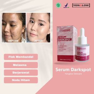 Yonglow Skincare Serum Darkspot Resmi BPOM Formulasi dr Yong Serum Penghilang Noda Hitam Wajah Serum Penghilang Flek Melasma Membandel