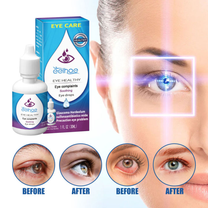 30ml Eye Drops Eye Protection Relieve Fatigue Dry Treat Red Prevention