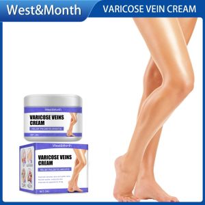 West Month Veins Treatment Cream Varicose Veins Treatment Cream Varicose Veins Remover Effective Original Veins Care For Varicose Body Leg Relief Inflammation Tightens Skin Varicosity Angiitis Remedy Ointment Phlebitis Legs Varicose Veins Gel (30g)