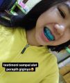 [TAHAP 1] Perapih gigi tonggos original asli Perapih gigi maju ke depan Behel gigi lepas pasang asli original Behel perapih gigi carang gingsul renggang asli dokter Alat perapih gigi monyong Alat perapih gigi maju ori Teeth Trainer Alignment Asli 100% ORI. 