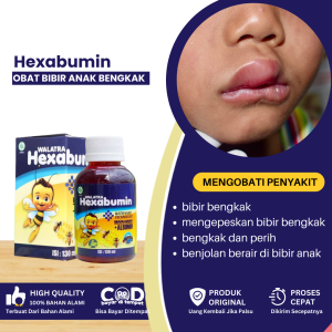 Obat Bibir Anak Bengkak Obat Untuk Mengempeskan Bibir Bengkak Obat Bibir Anak Tiba Tiba Bengkak Obat Bibir Bengkak Dan Perih Obat Bibir Anak Pecah Pecah Benjolan Berair Di Bibir Anak Panas Dalam - Walatra Hexabumin