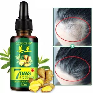 Serum Penumbuh Rambut 7 Days Serum Original Hair Regrowth Treatment Penumbuh Rambut Hitam