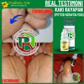 Obat Kaki Rayapan Bau, Obat Pitted Keratolysis, Obat Telapak Kaki Bolong Bolong Kecil, Obat Kaki Pecah Dan Kering, Kaki Rorombeheun, Kaki Bolong2, Kaki Rinyuhan, Lubang Kecil Kecil di Telapak Kaki - PROPOLIS SM 100% ASLI ORIGINAL. 