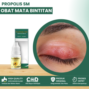 Obat Mata Bintitan Obat Kelopak Mata Bengkak Obat Mata Bintitan Kalazion Obat Penghilang Benjolan Di Kelopak Mata Obat Mata Candil Obat Bisul Di Kelopak Mata Obat Mata Timbilan Dengan Propolis SM