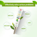 Acne Cream whitening moisturizing cream acne removal essence 30g facial essence cream scar acne remo Pimple Eraser. 