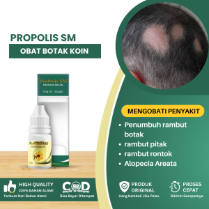 Obat Penumbuh Rambut Botak Obat Botak Koin Rambut Pitak Obat Penumbuh Rambut Obat Penumbuh Rambut Rontok Alopecia Areata Penumbuh Rontok - Propolis SM