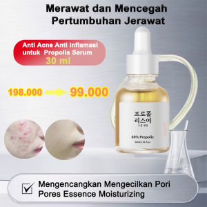 Anti Acne Anti Inflamasi untuk  Propolis Serum  Pengecil pori pori wajah Serum Pengencang Melembabkan  Serum  30ml Merawat dan Mencegah Pertumbuhan Jerawat Mengencangkan Mengecilkan Pori Pores Essence Moisturizing