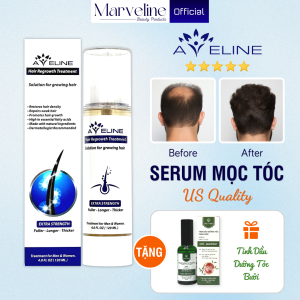 Tinh chất hỗ trợ tóc mọc nhanh Aveline Hair Regrowth Treatment Extra Strength chính hãng Mỹ