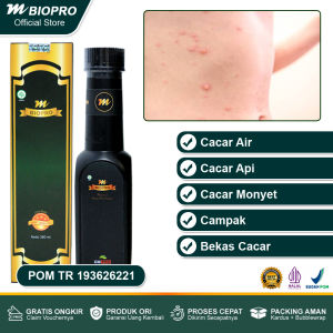 Obat Cacar Paling Ampuh Cacar Air Cacar Api Cacar Monyet Penghilang Bekas Cacar Bopeng Cacar Luka Cacar Demam Cacar Campak Herbal Cacar Untuk Anak Dan Dewasa - Mbiopro Asli Original