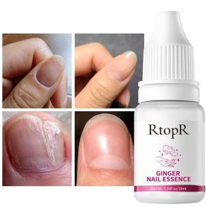 Guze [Mới] rtopr 10ml tinh chất chăm sóc móng gừng điều trị móng tay tinh dầu chất lỏng Serum phục hồi móng dưỡng ngón chân và móng tay nhẹ và không gây kích ứng