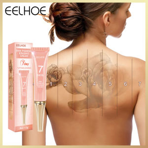 Eelhoe Skin Pigment Erasing Cream Tubed Natural Gentle Painless Tattoo Pigments Erase Cream for Skin Tattoo Cleaning Cream Tattoo Remover Painless Moisturize Skin Gel(13g)