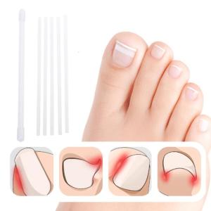 5pcs móng chân mọc trong dải rõ ràng móng chân mọc trong Corrector các bản vá lỗi móng chân chỉnh Stickers cho nam nữ chăm sóc bàn chân
