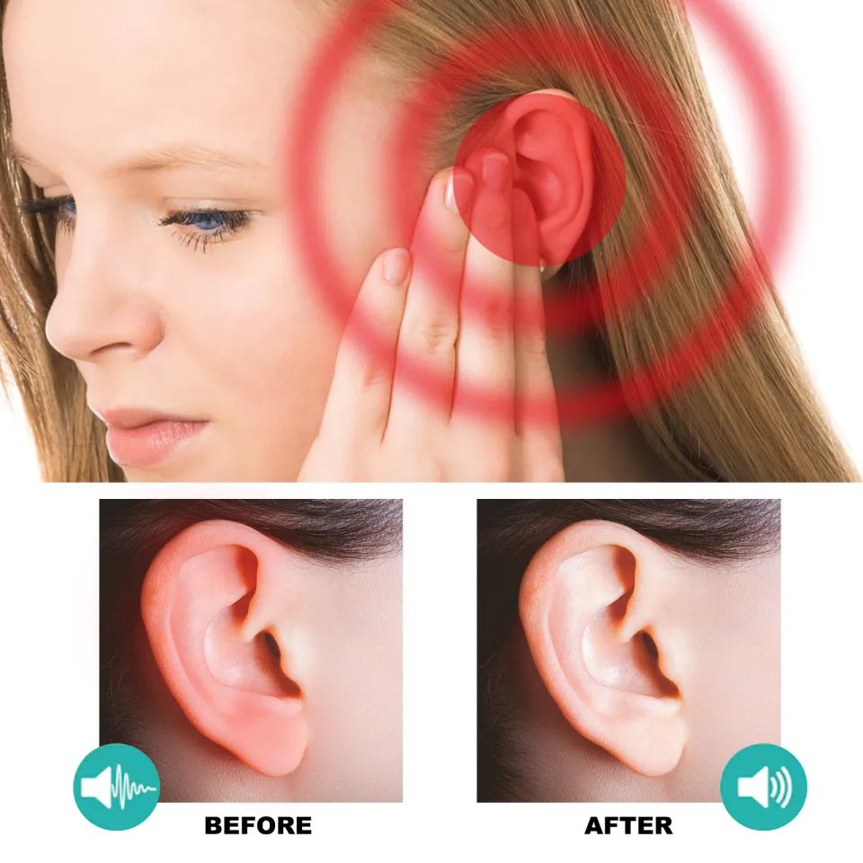 Eelhoe Ear Tinnitus Treatment Patch Deafness Ear Swelling Buzzing