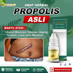 Obat Keloid Menonjol Tahunan Di Dada Benjolan Daging Tumbuh Bekas Luka Lama Menahun Propolis SM