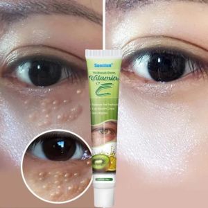 Kem Mắt Vitamin E Tẩy Mụn Thịt Quanh Mắt Hiệu Quả - Dưỡng Chất Thẩm Thấu Nhanh