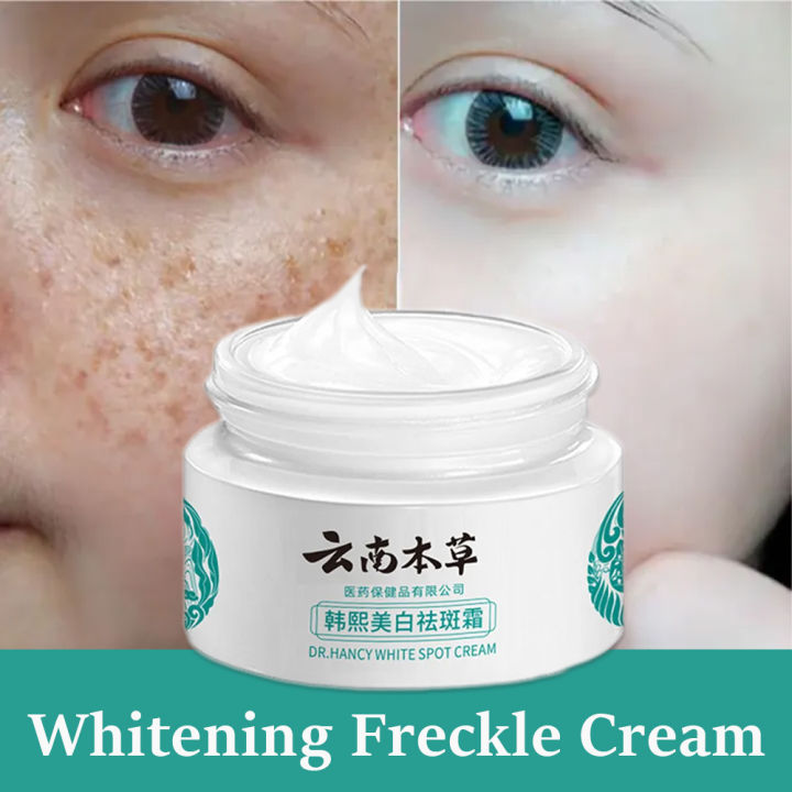 Melasma Cream Kelupas Krim Flek Tebal Membandel / Cream Melasma Parah ...