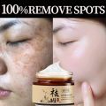 【100% Authentic】Original Melasma Cream Pekas Remover Collagen Japan Pekas Remover  Pekas & Freckles Remover Cream. 