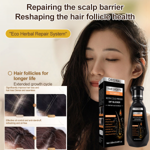 🔥Hot Sale🔥Trade Ginger Oil Control Hair Ginger Hair Growth Shampoo For Hair Loss Treatment Anti Hair Fall Strengthening Roots Volumizing Scalp Care For Thinning Hair Men Women Ginger Shampoo Daily Hair Care Shampoo