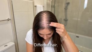 Spray –tin & Rosemary oil -Multi-Effect Scalp ment for Thinning Hair – With Ginseng & Arborvitae for Strengthening & Shine – 60ml per Bottle