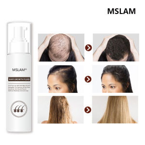 Tinh Chất Giúp Mọc Tóc Và Phục Hồi Tóc Hiệu Quả MSLAM Hair Growth Fluid Giải Pháp An Toàn Cho Người Bị Rụng Tóc