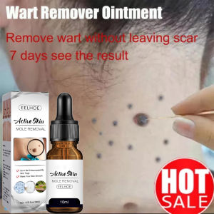 【EELHOE】 Wart Removal Serum Esensi Penghilang  Esensi Penghilang Kutil Mudah Dibawa Untuk Semua Kulit Esensi Penghilang Kutil