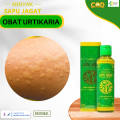 Obat Urtikaria, Obat Biduran, Bentol Bentol, Obat Gatal Biduran, Obat Biduran Menahun, Obat Kulit Gatal, Perdangan Kulit, Obat Gatal Seluruh Badan Dengan Minyak Sapu Jagat. 